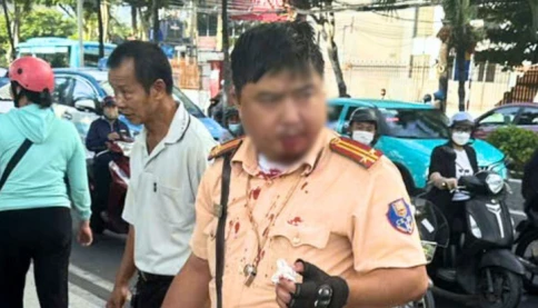 Du khách người Nga đấm CSGT Nha Trang thương tích có nồng độ cồn kịch khung