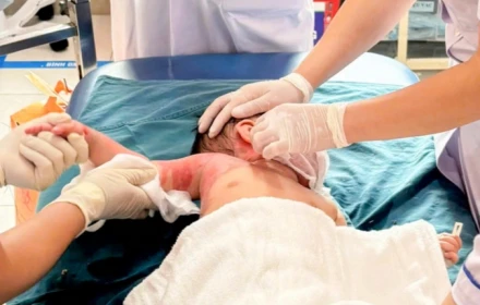 Quá thương tâm 3 trẻ trong một gia đình bị bỏng do lật nồi lẩu ở Hà Nội