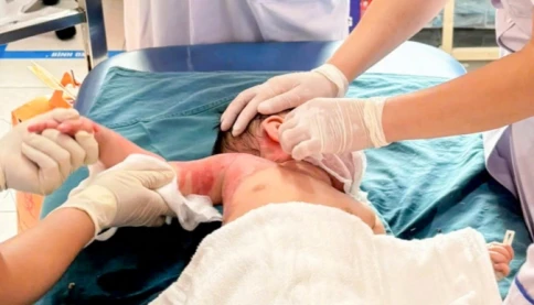 Quá thương tâm 3 trẻ trong một gia đình bị bỏng do lật nồi lẩu ở Hà Nội