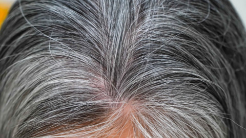 Vì sao tóc bạc không thể đen trở lại?