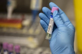 Sau 2 năm trời, Australia mới thừa nhận bị thất lạc 300 lọ virus chết người