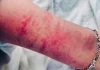 Tòa phải hoãn xét xử bác sĩ h.iếp d.âm thai phụ bị hại ngất xỉu,