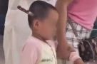 Bé 3 tuổi đi bộ vào bệnh viện với con da o cắm vào đầu