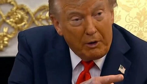 Bàn tay của Tổng thống Trump có vẻ bị bầm tím. Không rõ là gì, nhưng chắc chắn không phải