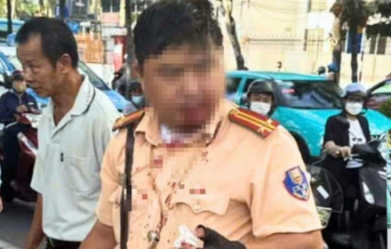Khởi tố thanh niên nước ngoài đấm vào mặt trung tá cảnh sát giao thông