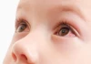 Có đúng là bạn sẽ không bị đau mắt đỏ nữa sau khi đã khỏi bệnh không?
