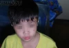 Công an Hà Nội khẩn trương làm rõ vụ bé trai có dấu hiệu bị mẹ kế bạo hành đang gây xôn xao dư luận