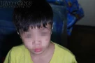 Công an Hà Nội khẩn trương làm rõ vụ bé trai có dấu hiệu bị mẹ kế bạo hành đang gây xôn xao dư luận