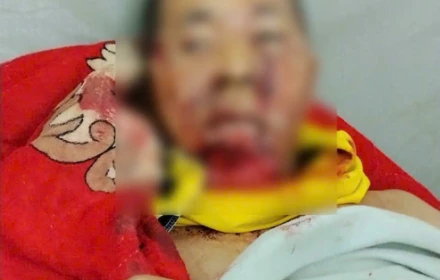 Một người đàn ông bị gấu rừng tấn công trên đường về nhà ở Đà Nẵng