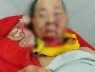 Một người đàn ông bị gấu rừng tấn công trên đường về nhà ở Đà Nẵng