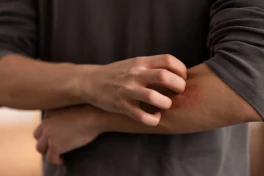 Gãi ngứa: Vừa hại vừa lợi? Nghiên cứu mới hé lộ sự thật bất ngờ về vòng luẩn quẩn ngứa-gãi