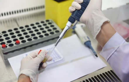 Kẻ thù giấu mặt của phong độ đàn ông