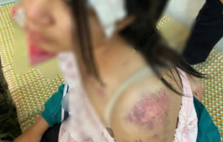 Bốn giờ bạo hành kinh hoàng và cú nhảy tìm đường sống của bé gái 12 tuổi