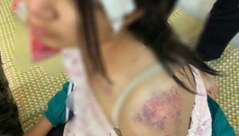 Bốn giờ bạo hành kinh hoàng và cú nhảy tìm đường sống của bé gái 12 tuổi