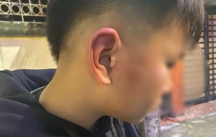 Công an xác minh nghi vấn bé trai ở Hà Nội bị bố của bạn hành hung khi đến nhà bạn học chơi