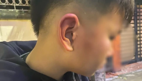 Công an xác minh nghi vấn bé trai ở Hà Nội bị bố của bạn hành hung khi đến nhà bạn học chơi