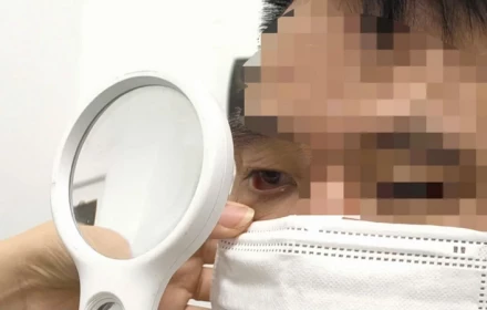 Ngứa dữ dội vùng  kín, người đàn ông tá hỏa khi bác sĩ tìm ra "thủ phạm", không cẩn thận có thể lan lên mắt