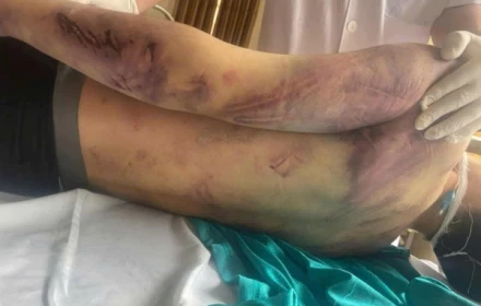 Vụ học viên tử vong ở Trung tâm CTXH Hải Hà: Gã bảo vệ khai gì khi hành hung nạn nhân?