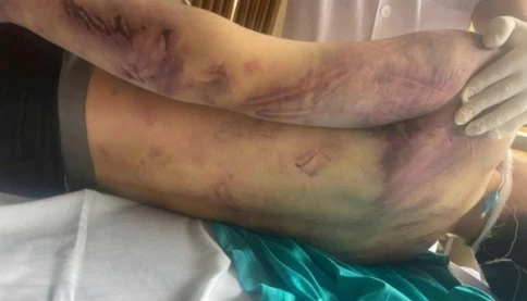Vụ học viên tử vong ở Trung tâm CTXH Hải Hà: Gã bảo vệ khai gì khi hành hung nạn nhân?