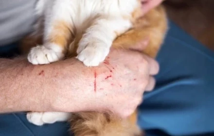 Bị mèo cào, người đàn ông ở TP.HCM tử vong thương tâm