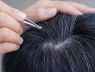 Một thói quen phổ biến ai bị tóc bạc cũng làm khiến tóc càng bạc, càng thưa