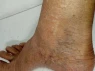 KÍCH HOẠT TUẦN HOÀN MÁU CHÂN