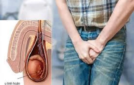 4 sự thật về ung thư tinh hoàn mà ít nam giới biết