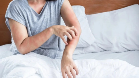 8 dấu hiệu thận yếu biểu hiện ngay trên da