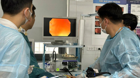 4 nhóm người cần nội soi dạ dày sớm