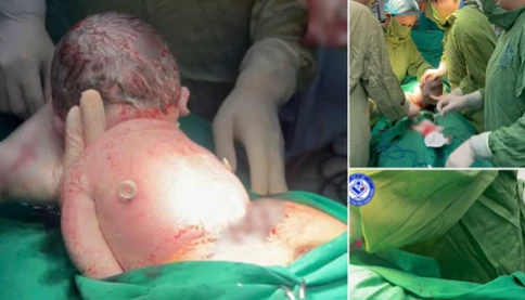 Hành trình sinh tồn kỳ diệu từ trong bụng: Em bé bị tràn dịch màng phổi từ tuần thai 23 vừa chào đời mạnh khỏe!