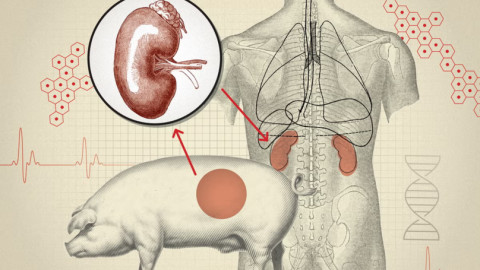 Ghép tạng từ lợn sang người có thể cứu sống con người một ngày nào đó