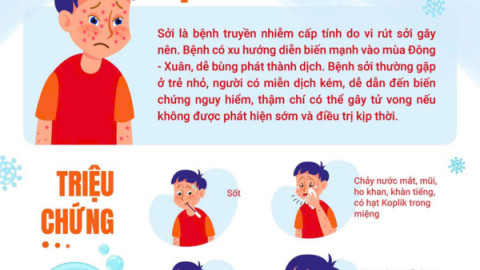 Bệnh sởi và cách phòng chống cho cộng đồng