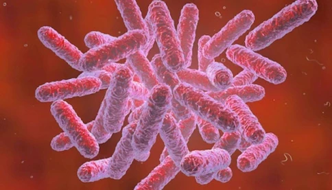 Bệnh Whitmore là gì và vì sao dễ bị bỏ sót?