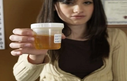 Trào lưu uống và bôi nước tiểu để làm đẹp và chữa bệnh: Sự thật phía sau khiến nhiều người “vỡ mộng”