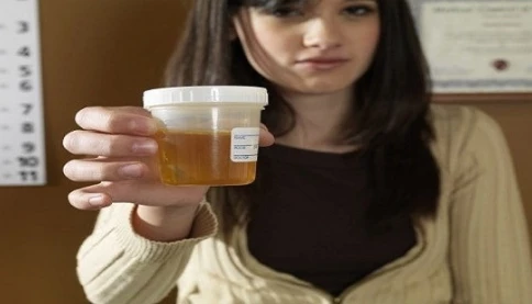 Trào lưu uống và bôi nước tiểu để làm đẹp và chữa bệnh: Sự thật phía sau khiến nhiều người “vỡ mộng”