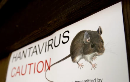 Bệnh nhân du thuyền liên quan đến Hantavirus nhập cảnh vào Nam Phi: Truy dấu tiếp xúc đã được bắt đầu