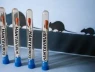 Hantavirus có nguy hiểm không? Có thể gây tử vong như thế nào?