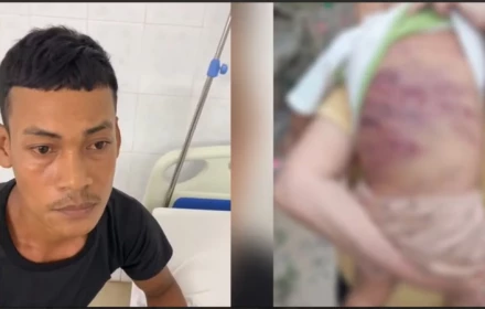 Lời khai của gã cha dượng trong vụ bé trai 2 tuổi bị bạo hành đến nguy kịch