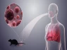 Virus Hanta là gì? Cảnh báo bệnh lây từ chuột có thể gây tử vong