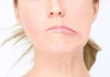 Một thói quen mùa hè có thể khiến nhiều người bị lệch mặt