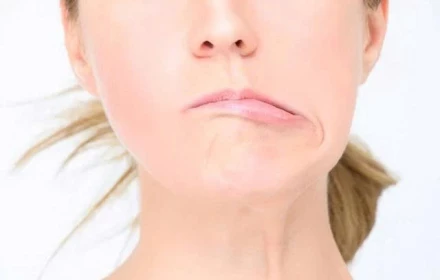 Một thói quen mùa hè có thể khiến nhiều người bị lệch mặt