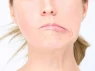 Một thói quen mùa hè có thể khiến nhiều người bị lệch mặt