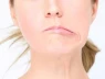 Một thói quen mùa hè có thể khiến nhiều người bị lệch mặt
