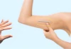 Tại sao một số chị em cấy que tránh thai xong tăng cân thấy rõ?