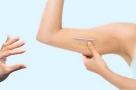 Tại sao một số chị em cấy que tránh thai xong tăng cân thấy rõ?