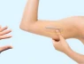 Tại sao một số chị em cấy que tránh thai xong tăng cân thấy rõ?