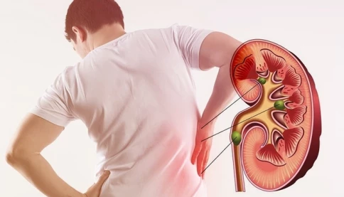 5 dấu hiệu bất thường trong nước tiểu cảnh báo tổn thương thận sớm