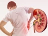 5 dấu hiệu bất thường trong nước tiểu cảnh báo tổn thương thận sớm