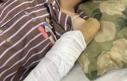 Chồng cô gái bị cuốn vào máy ép nước mía xin dừng nhận hỗ trợ sau khi đủ viện phí