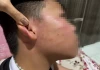 Xác minh vụ học sinh lớp 4 nghi bị giáo viên dạy thêm đánh bầm tím vùng mặt